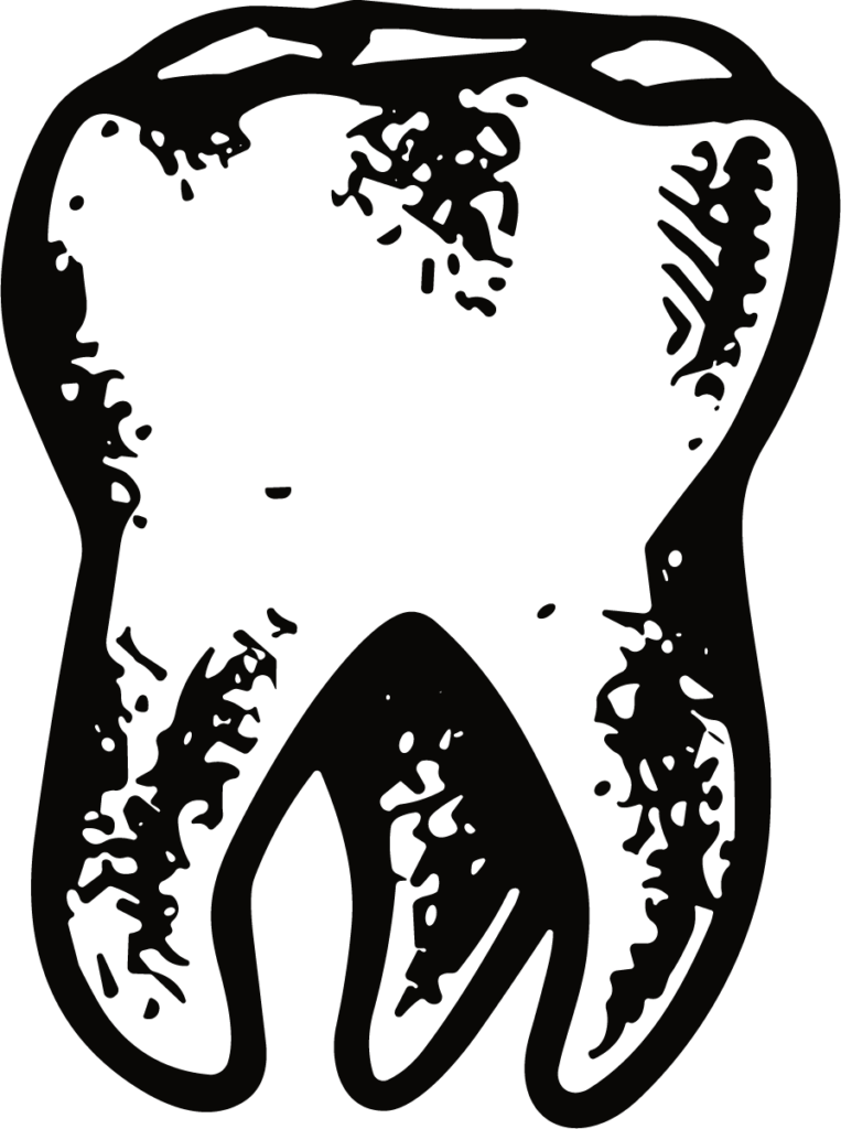 Tooth Illustration SVG Gritty Sketch Vector