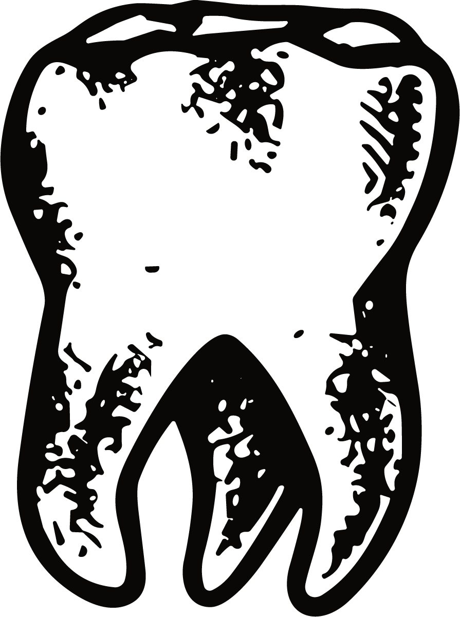 Tooth Illustration SVG Gritty Sketch Vector - Image 1